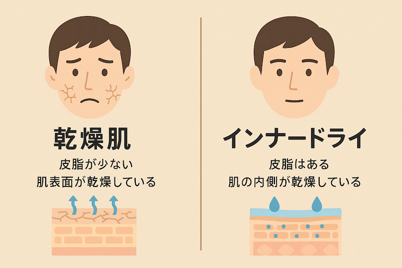 乾燥肌とインナードライの違いを説明した画像